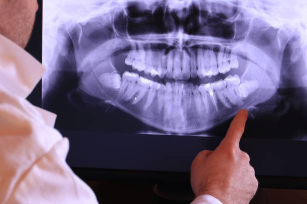 Best Emergency Dental Care for Broken or Chipped Teeth in Purdy, MO