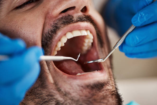 Best Emergency Treatment for Dental Infections or Abscesses in Purdy, MO